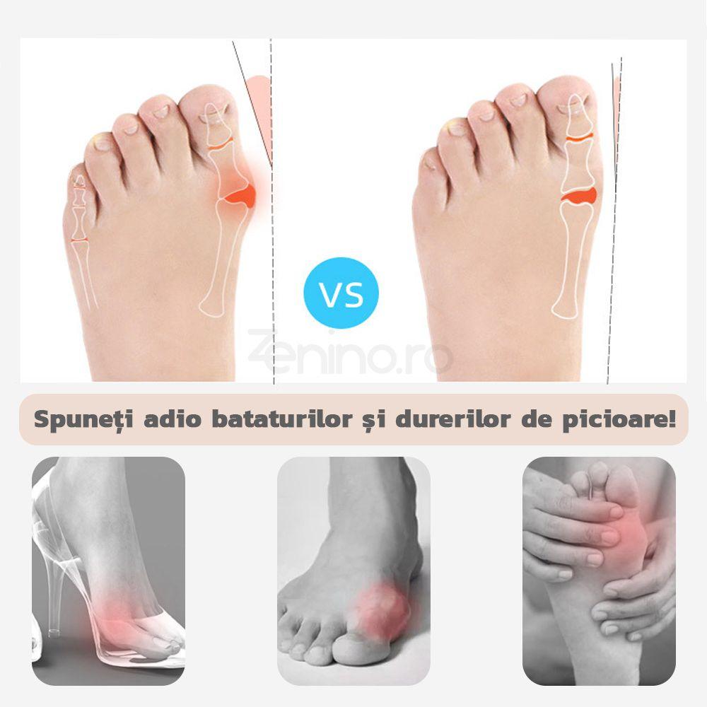 Set 2 Corectoare pentru Degete, Reduce Inflamatiile, Potrivit pentru Monturi, Dimensiune Universala, din Silicon, Culoarea pielii